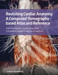 revisiting-cardiac-anatomy-a-computed-tomography