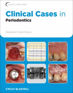 clinical-cases-in-periodontics