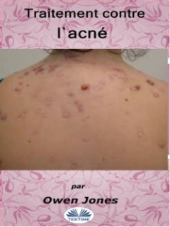 traitement-contre-lacn